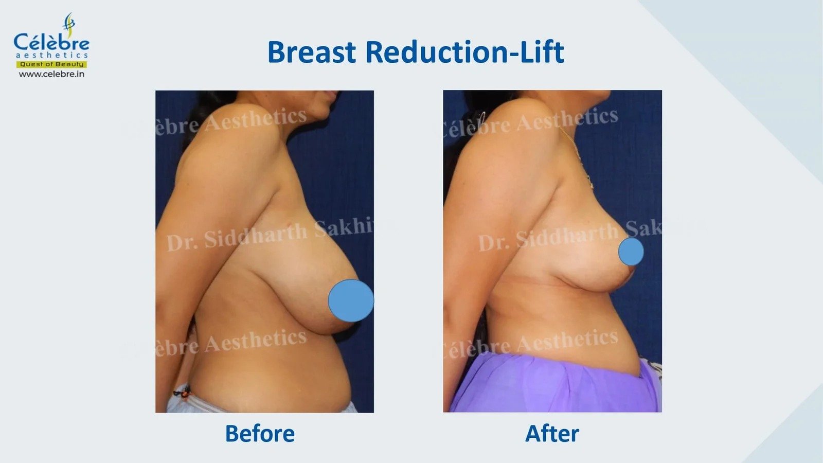 imgi_3_PPT-1_page-0027