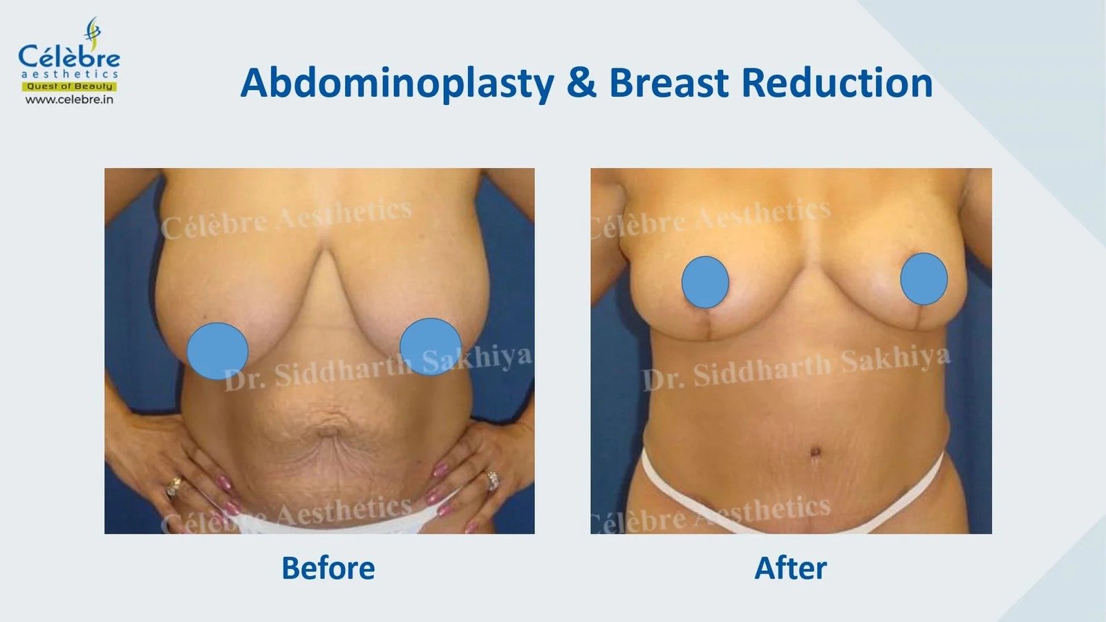 imgi_4_PPT-1_page-0028