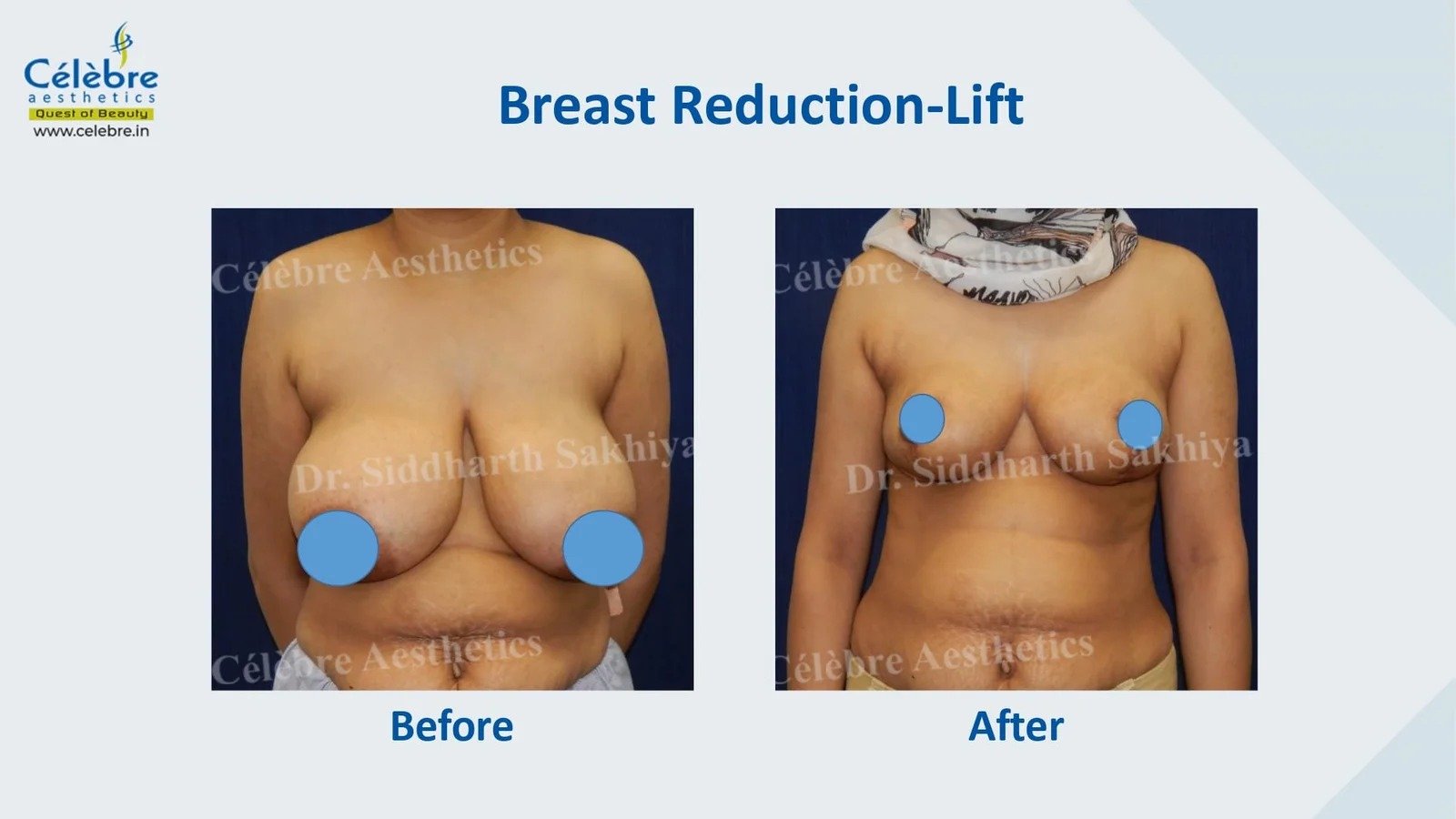 imgi_8_PPT-1_page-0025